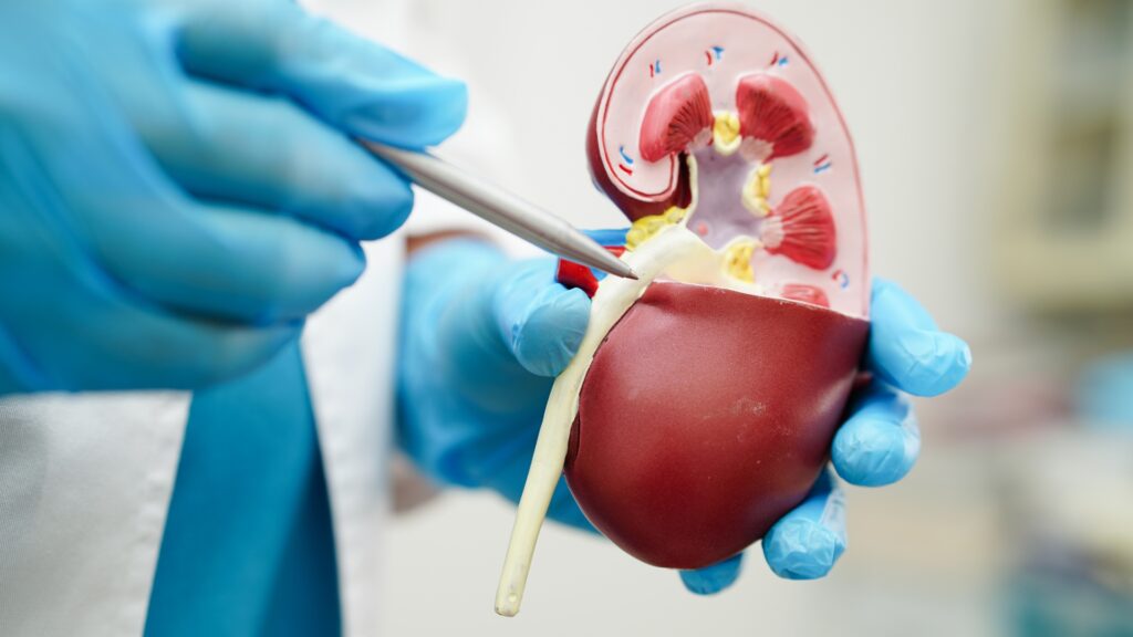 Obstrucción urinaria: Causas, diagnóstico y tratamiento