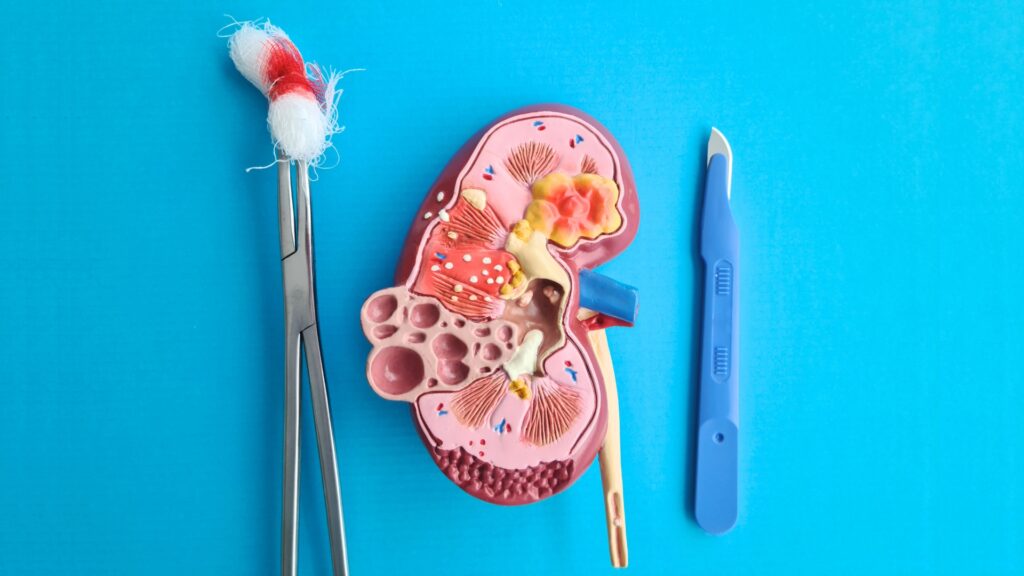 Cirugía renal abierta vs laparoscópica: Diferencias